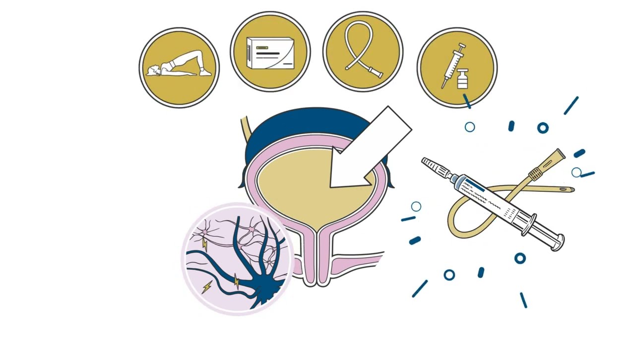 Trailer: Videoserie zur Aufklärung bei neurogener Blase