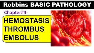 Chp4 (Part2) Robbins Basic Patho | Hemostasis | Thrombus | Embolism | General Pathology