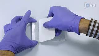 Optimization of a Multiplex RNA based Expression Assay Using Breast Cancer Archival Material