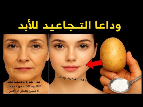 ضعيها علي التجاعيد ستختفي فورا حتي لو عمرك 70 سنة يزيل التجاعيد فورا تبدين أصغر سن
