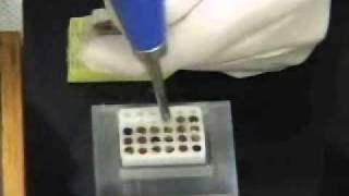 Tissue Microarray procedure