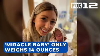 Premature ‘miracle baby’ born in Portland weighed only 14 ounces