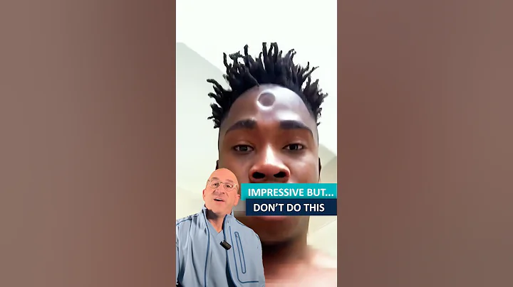 Easiest Skull Bone To Fracture⁉️ #shorts