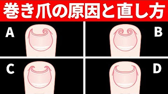 Nan Nan Back Undefined Skip Navigation Search Search Sign In Undefined Home Home Explore Explore Subscriptions Subscriptions Library Library History History Unavailable Videos Are Hidden Play All 巻き爪治療 134 Videos 0 Views Last Updated