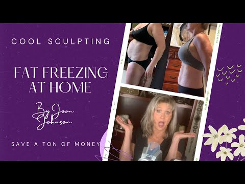 FAT FREEZING BEFORE AND AFTER | Home Fat Freezing | This is my 2nd round of fat freezing at Home