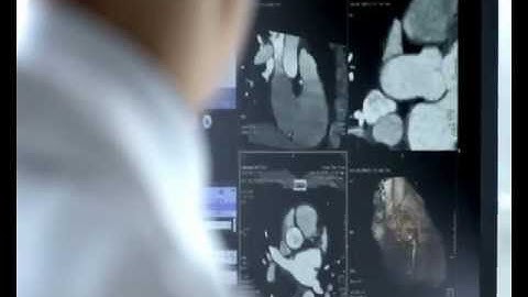 Siemens SOMATOM Definition Flash