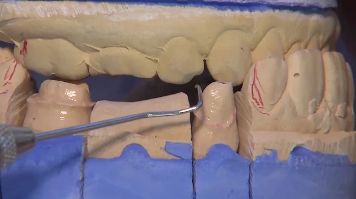 Case of the Week: Examining the Rule of 27
