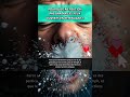 Les éternuements vont plus vite que tu ne crois #science #facts #body