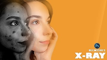 Enable “X-Ray” to Remove Blemishes in Photoshop. || PixxDel ||