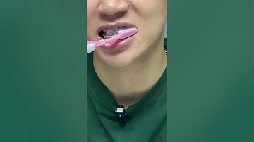 6/365: Cách để đánh răng khi niềng  #rangmieng #dentist #braces #niengrang