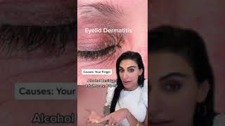 Eyelid Dermatitis #shorts | SkinByDrAzi