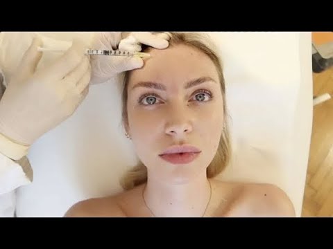 Video: Come è Stato Inventato Il Botox