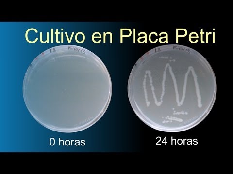 Video: ¿Cuál es el significado de la placa de Petri?