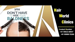 Best Hair Transplant Treatment In Coimbatore Hair World Clinics - Coimbatore
