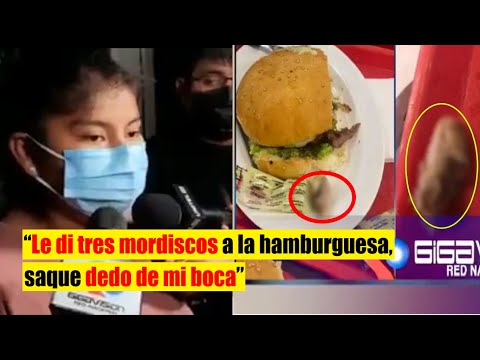 Mujer encuentra un dedo en su hamburguesa. Policía de Bolivia confirma que es de un humano