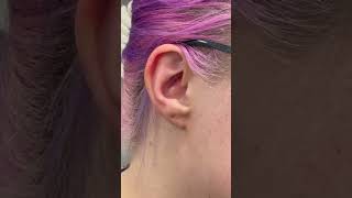 Auricular Microsystems - CAM Points on the Cymba Concha