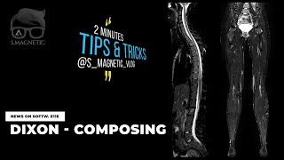 NEWS ON SOFTWARE E11e – DIXON COMPOSING