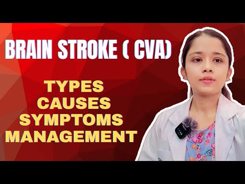 🧠 STROKE | Causes, Symptoms, Types, Management #Stroke #nursingexam #norcet