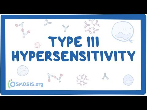 Type III hypersensitivity (immune complex mediated) - causes, symptoms & pathology