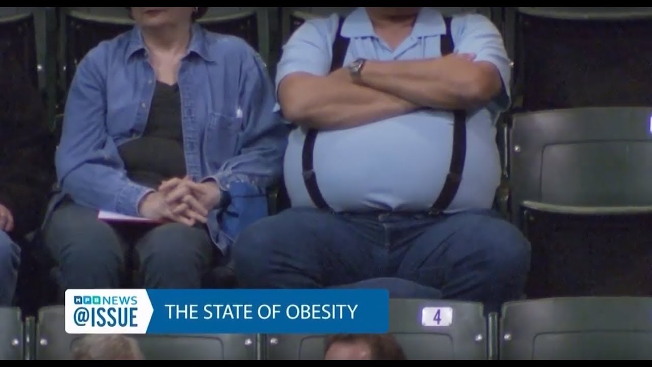 Obesity | @ISSUE | MPB