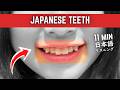 65 - 歯の見た目 - How Japanese teeth look like - Hikari sensei's podcast