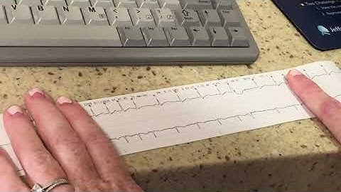 Printing Telemetry Strips