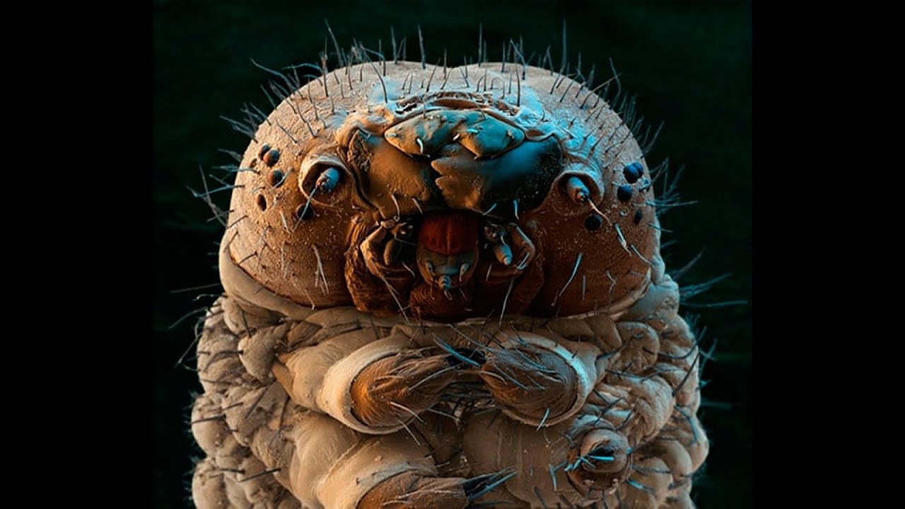 Ресницы под микроскопом. Клещ Demodex folliculorum микроскоп. Клещ демодекс под микроскопом. Клещи демодекс под микроскопом. Подкожный клещ под микроскопом
