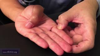 Zhongjian (T 11.05): Master Tung Point Location and Needling Technique in ENGLISH by Chuan-Min Wang