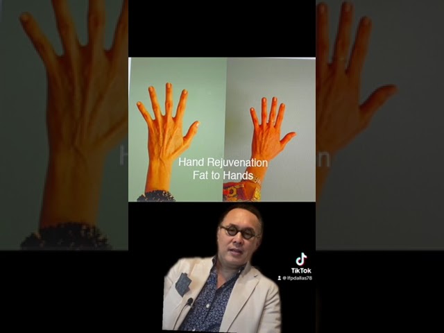 Why and How to Rejuvenate Hands