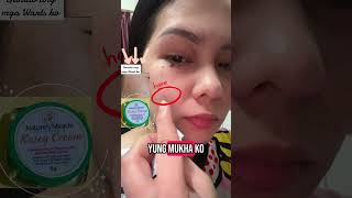 Goodbye Wartswarts Removerkasoy Cream Httpsvttiktokcomzshnkbgrctudevuagw