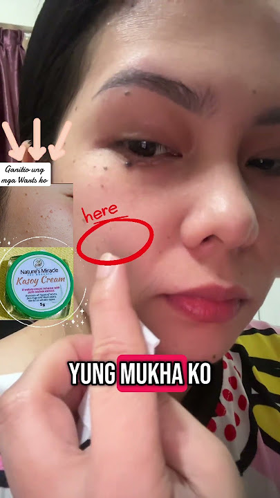 Download lagu Goodbye Warts|WARTS remover|Kasoy Cream. https://vt.tiktok.com/ZSHnkBGRCtUde-vUAgW/