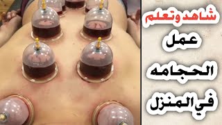 شاهد طريقه عمل الحجامه في المنزل+انواع الحجامه_فوائد الحجامه_ أفضل اوقات لعمل الحجامه