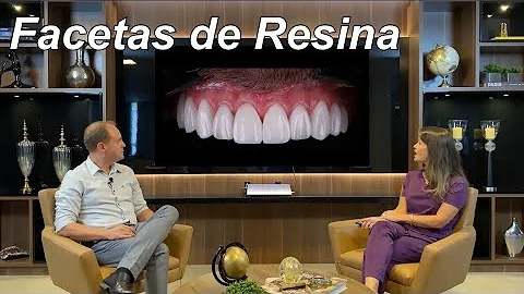 Quanto custa para fazer uma faceta de resina?