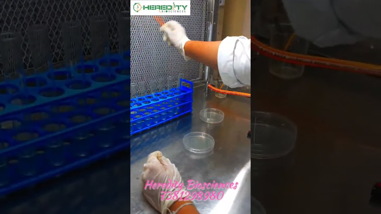 Perfecting Your Spread Plate Technique Microbiology