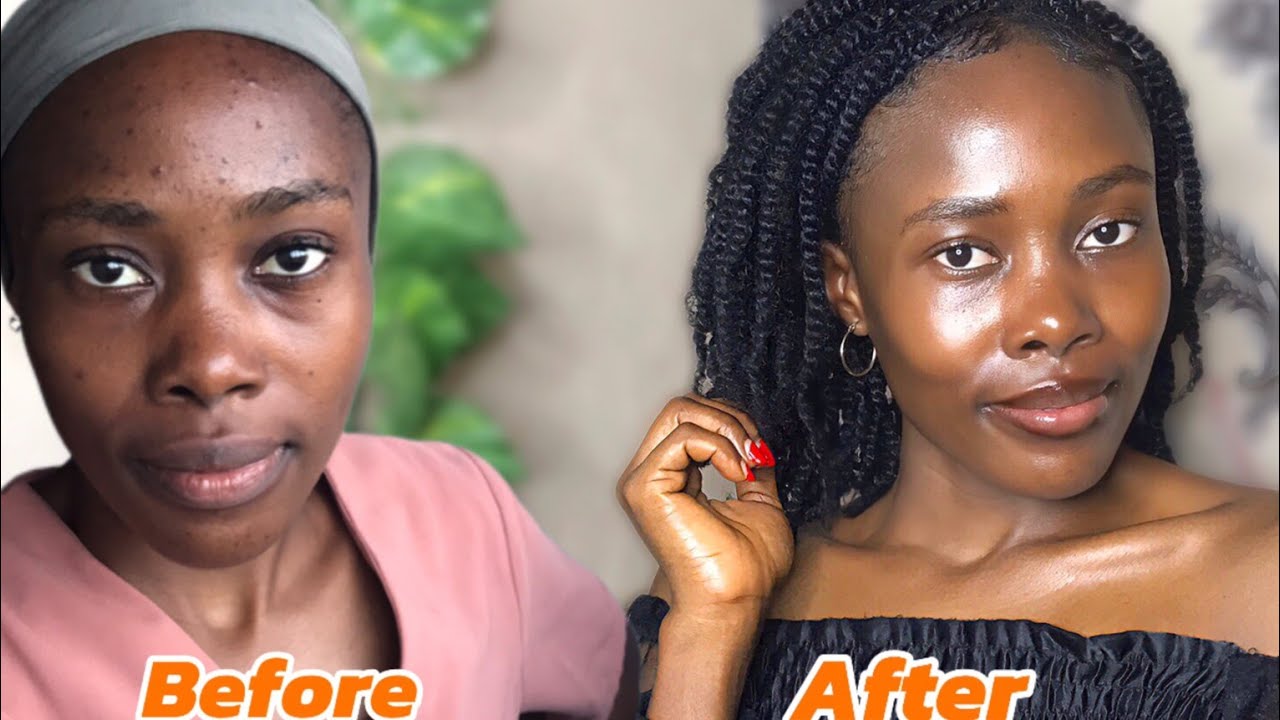 Caramel /Dark skin Combo✔️| How to achieve a smooth radiant skin without dark spots