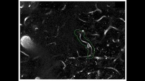 Stall Catchers - Flowing vs Stalled