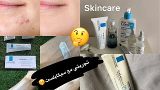 جبتلكم حل ل حب الشباب خطيير?-  cicaplast baume b5 review￼