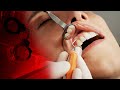 Стоматолог імітував бурхливу діяльність у чужому роті! Історія київського дантиста-садиста шокує