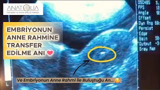 Embriyonun Anne Rahmine Transfer Anı Embriyo Transferi