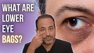 What Are Lower Eye Bags? Dr Ben Talei Beverly Hills Plastic Surgeon