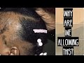 STOP 🛑 losing your edges!| Traction Alopecia