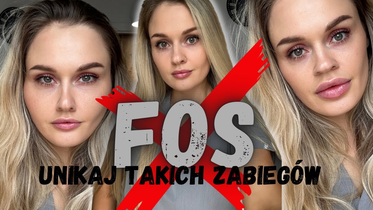 Te Zabiegi Zrujnowały Ich Twarze || FOS || Zespół Przepełnionej Twarzy