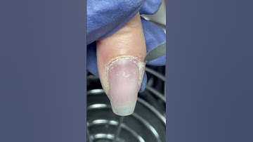 Don’t ever get confused again! #nailcare #naturalnails #nailtipsandtricks #nailanatomy #cuticles