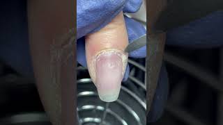 Don’t ever get confused again! #nailcare #naturalnails #nailtipsandtricks #nailanatomy #cuticles screenshot 2