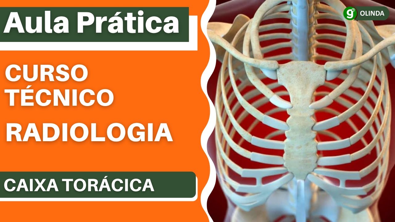 Aula Prática - Anatomia: Ossos da Caixa Torácica - YouTube