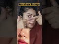 Perfect Nose Shape Naturally #ytshorts #noseshape #youtubeshorts