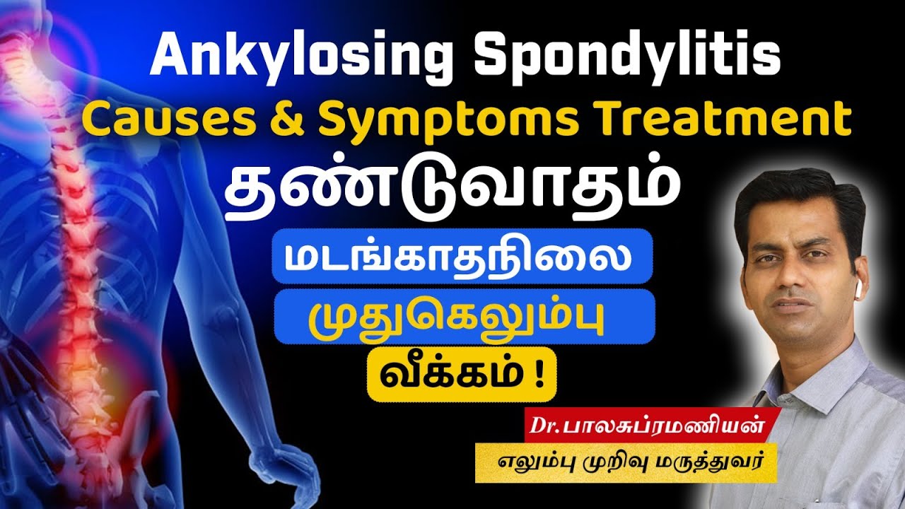 Ankylosing Spondylitis Causes | Symptoms | Treatment |தண்டுவாதம் மடங்காதநிலை முதுகெலும்பு வீக்கம் !