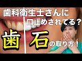 実は歯科衛生士さんに口止めされてます・・・自分で歯石を取る方法!