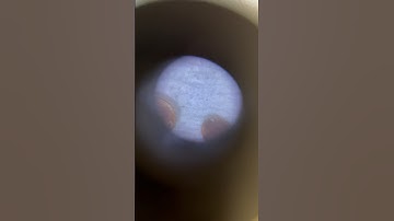 Under the Microscope! Varroa Destructor 🔬