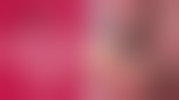 Implant placement Ridge split implant plate fracture & GBR - [Dr. Na Kiwon]